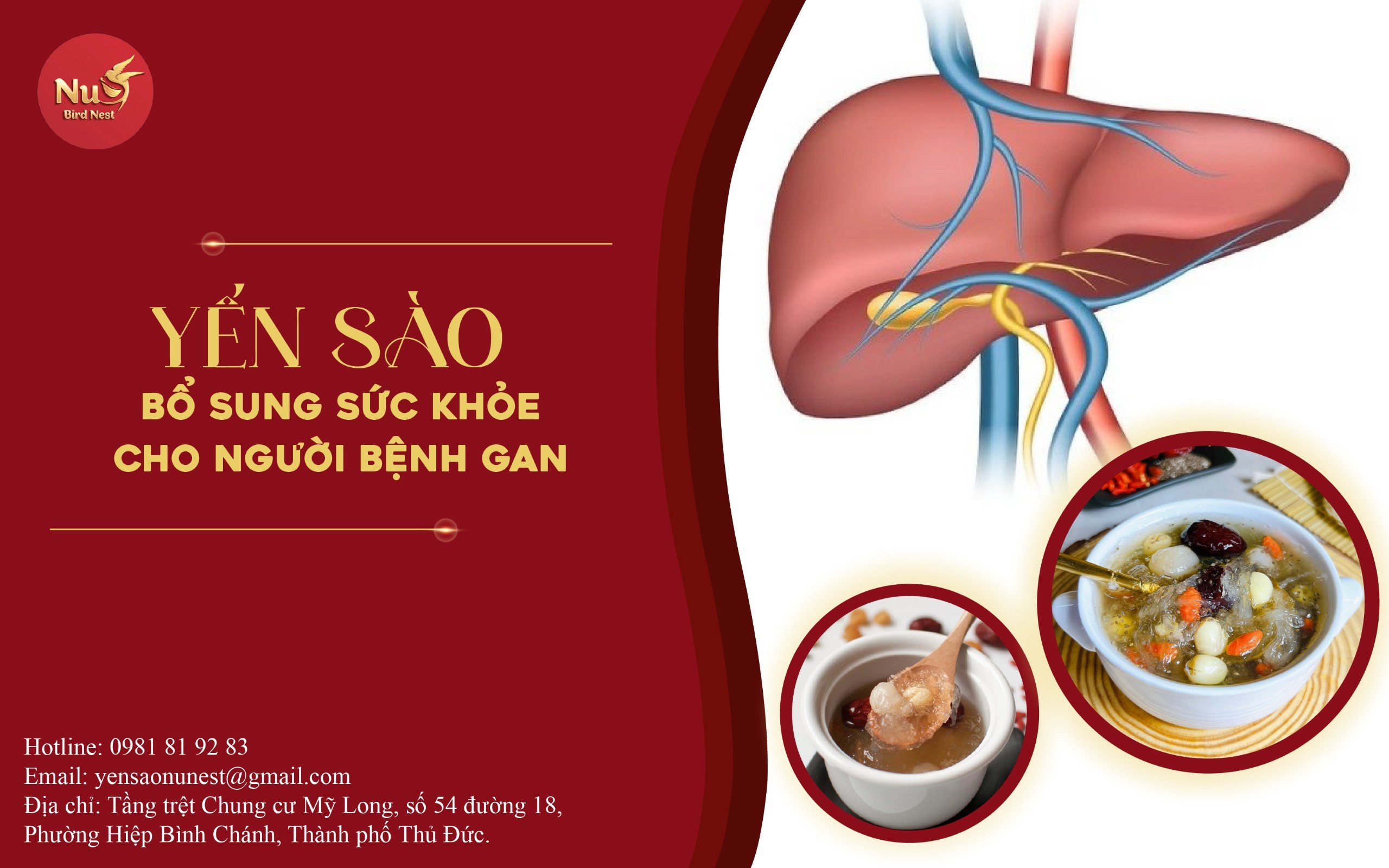 YẾN SÀO BỔ SUNG SỨC KHỎE CHO NGƯỜI BỆNH GAN